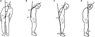 Technology-based therapy-response evaluation of axial motor symptoms under daily drug regimen of patients with Parkinson’s disease